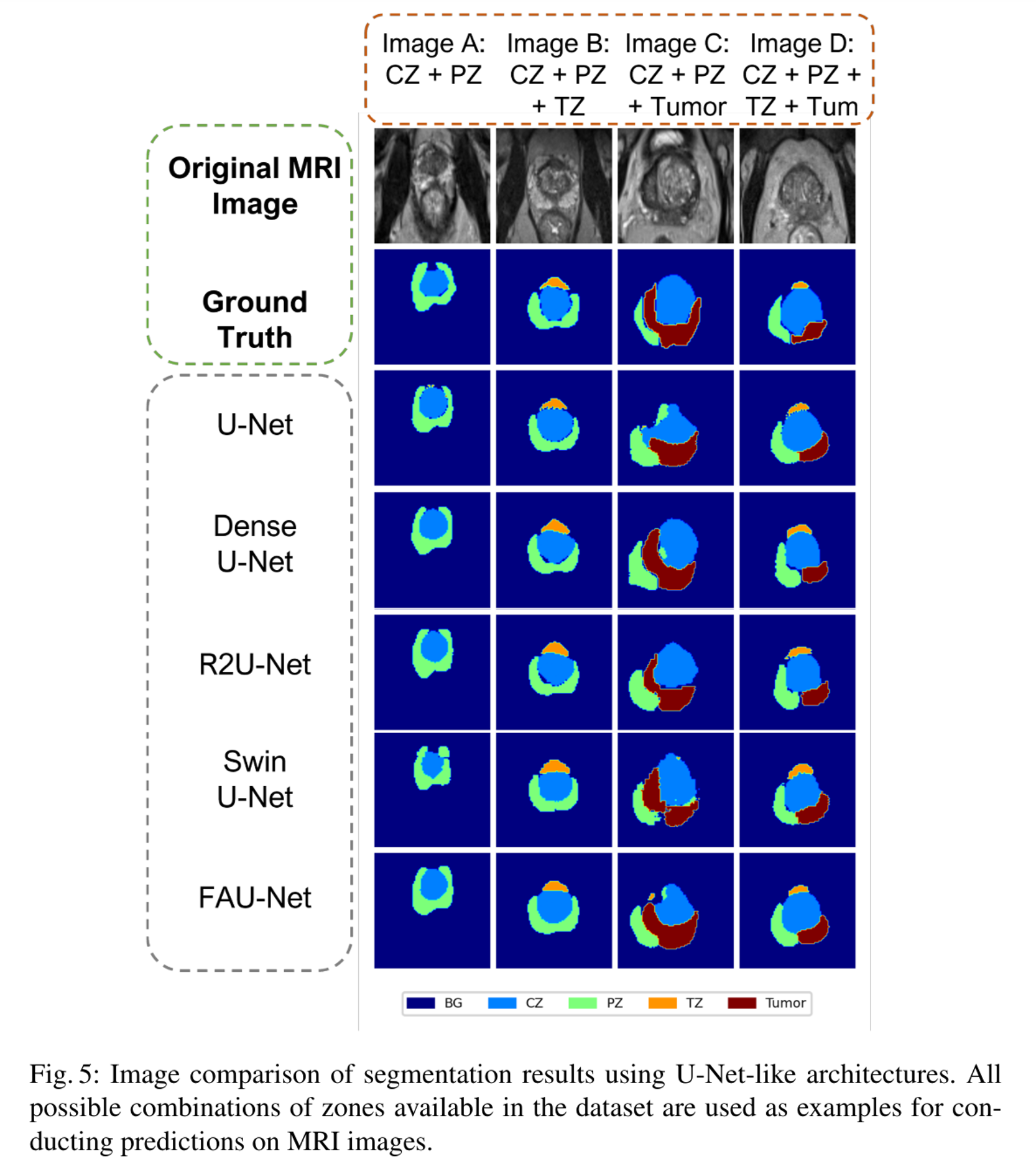 FAU-Net paper preview