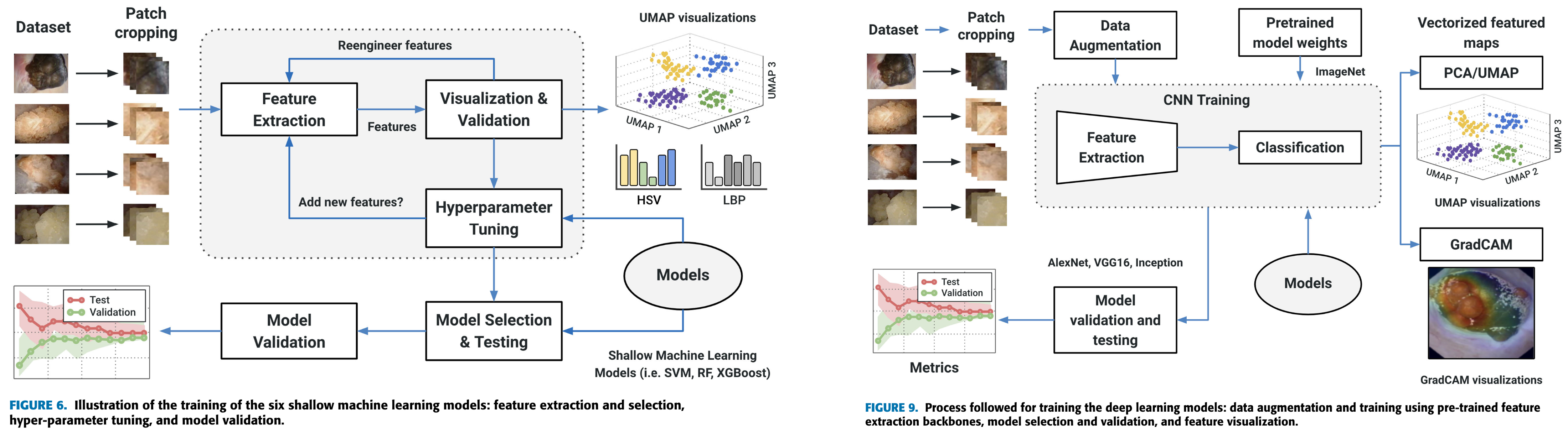 In Vivo Kidney Stones paper preview
